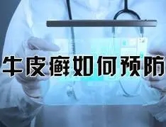 如何才能预防牛皮癣发病呢