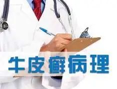 牛皮癣有什么危害