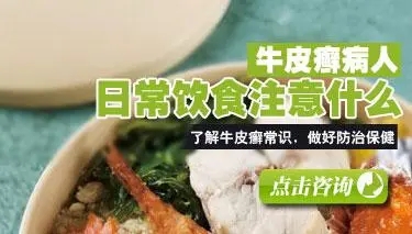 济南牛皮癣患者应该吃什么