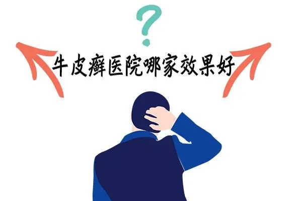 为什么牛皮癣长期不能治愈