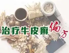 谈谈民间偏方治疗牛皮癣的利弊