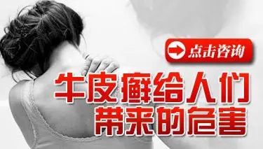 牛皮癣对患者造成什么心理危害