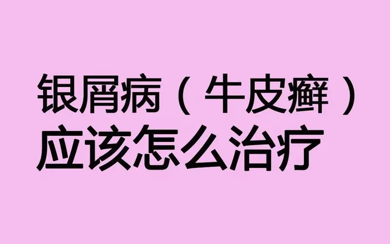 牛皮癣之所以如此顽固是为什么